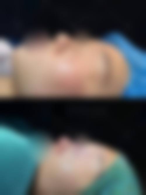 五、成都御美汇整形医院实例