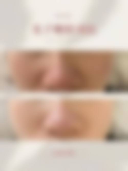 四、吉林金羽缇整形美容医院实例