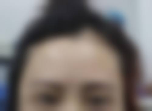 涂明医生在哪家医院怎么预约?