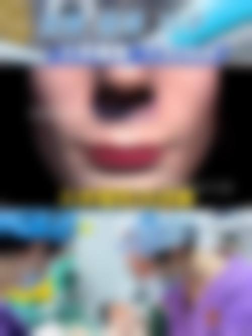 五、韩国美思科整形医院实例