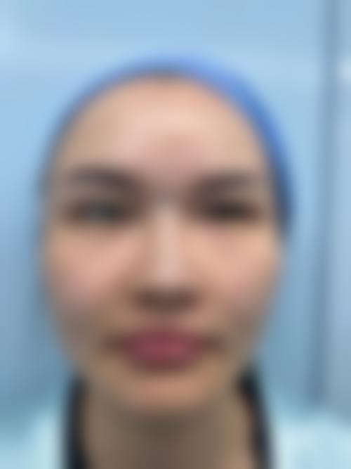 谢林海医生怎么样可靠吗?