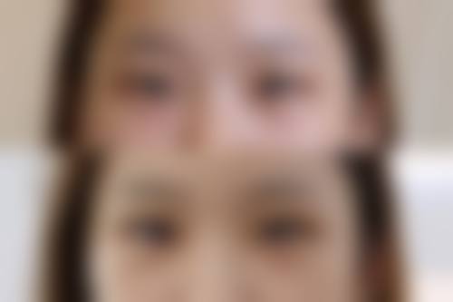 郑真伊医生实例