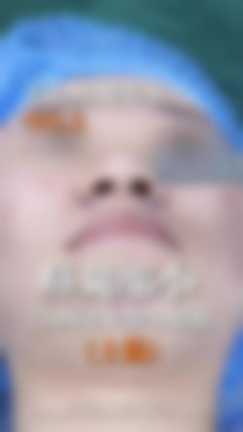 李允怡医生实例