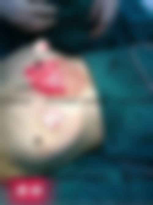 李允怡医生项目价格表参考
