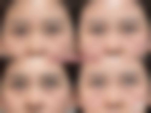 五、三亚福音国内外整形美容中 心实例
