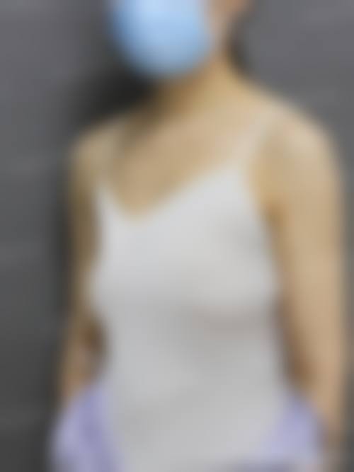 五、欧佩拉整形医院实例